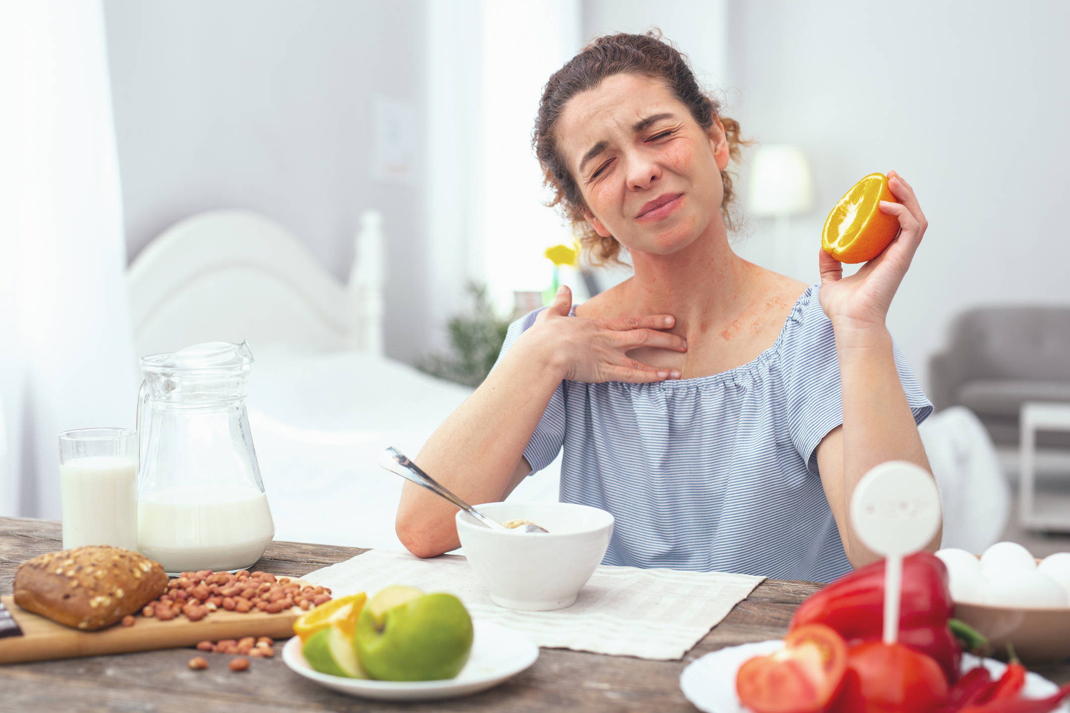 Pada dermatitis atopik, buah jeruk dilarang