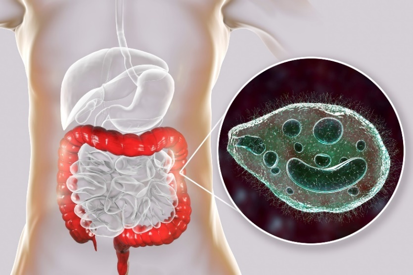 Balantidium coli - parasit yang menginfeksi usus besar pada saluran pencernaan manusia