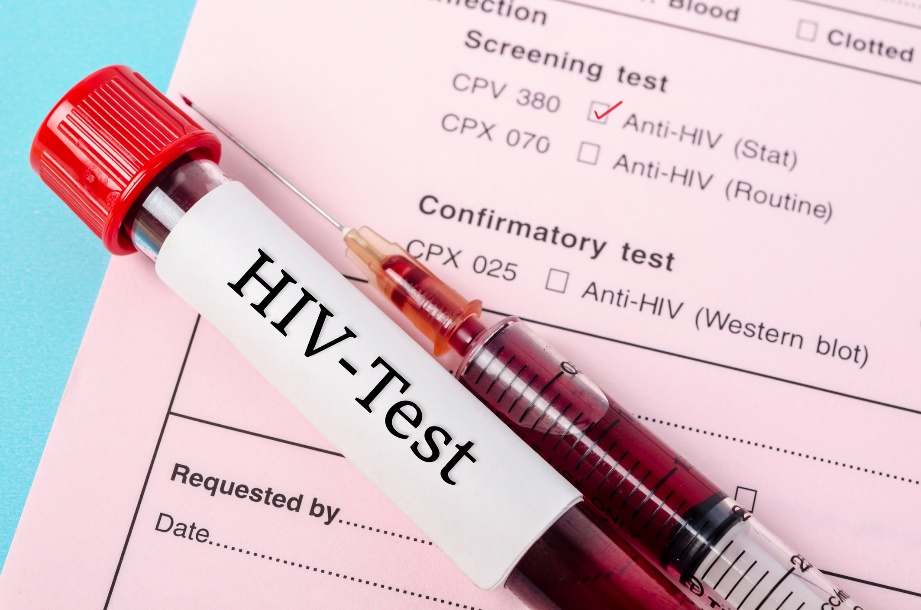 Tes diagnostik untuk mengetahui adanya antibodi anti-HIV dalam sampel darah pasien