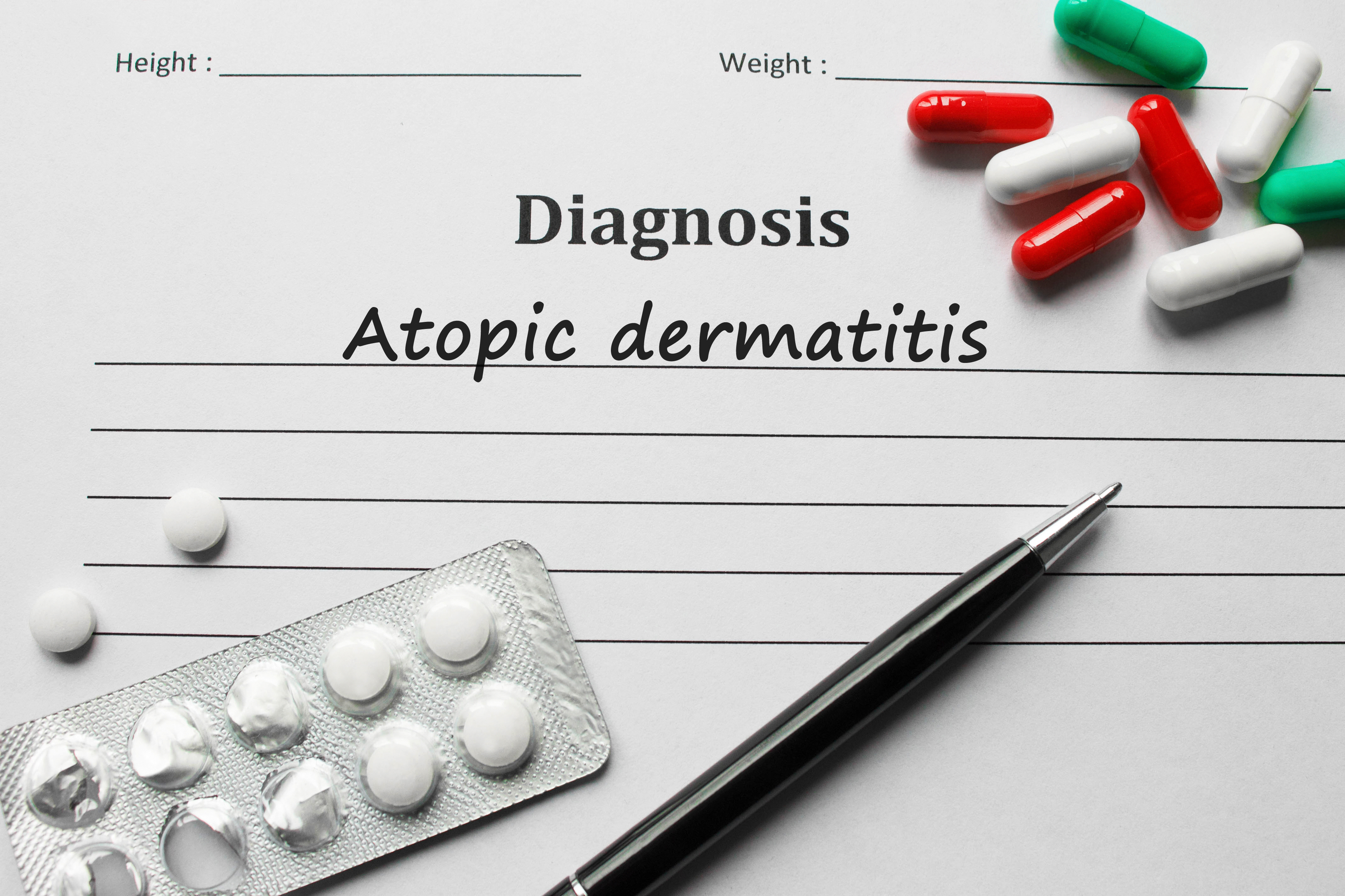 Diagnosis dermatitis atopik