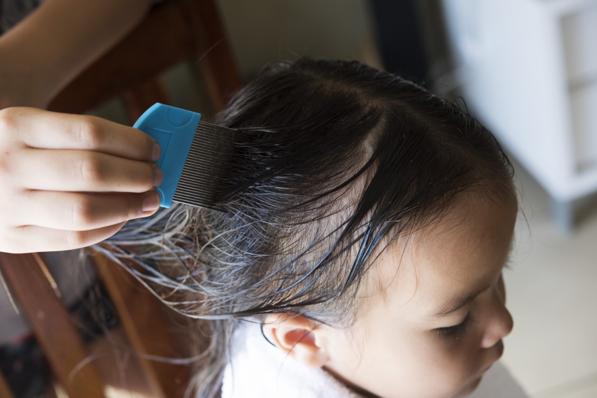 Seorang gadis dengan rambut yang sudah dicuci dan menyisir kutu rambut dengan sisir khusus yang dirancang untuk tujuan ini.