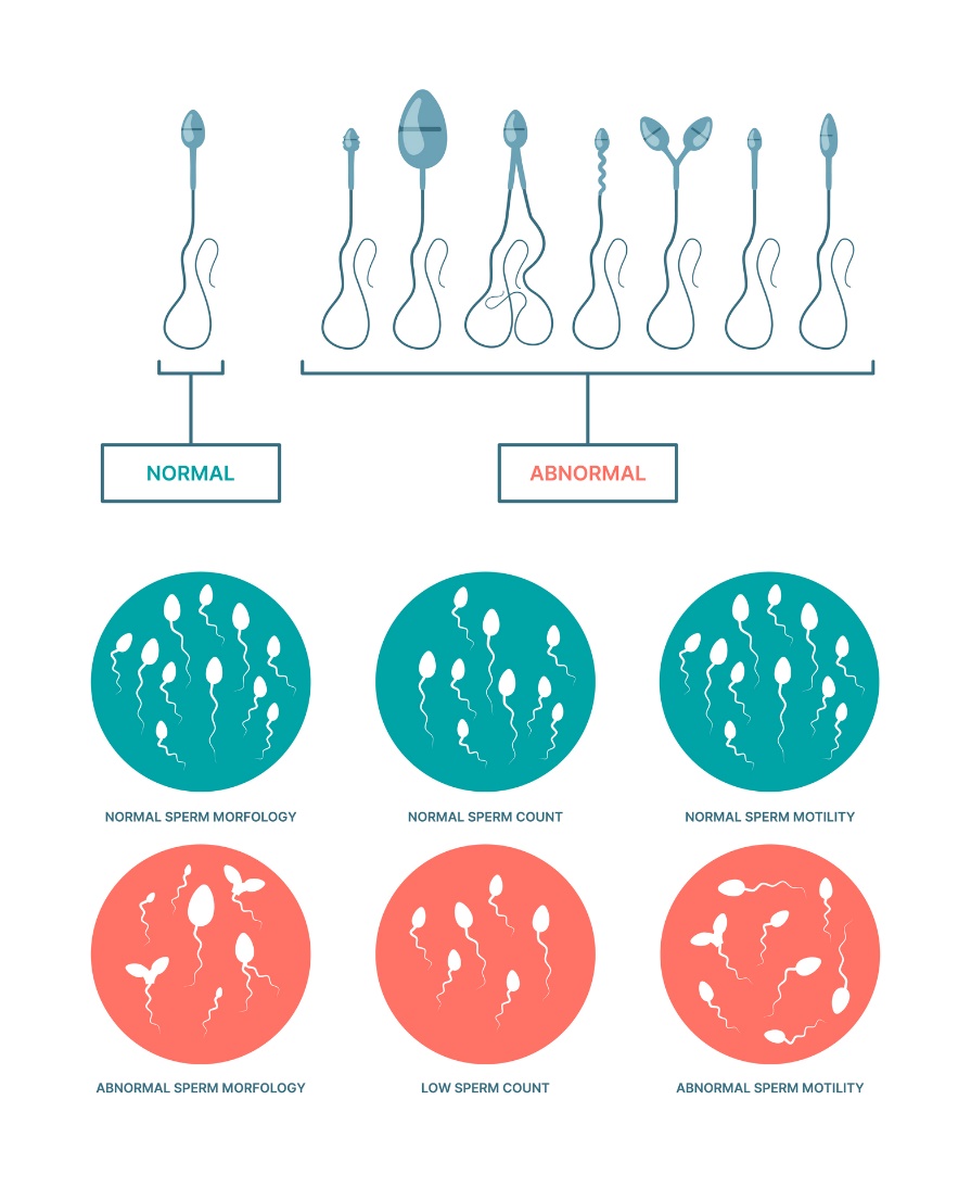 Kondisi fisiologis dan abnormal spermatozoa. Morfologi, jumlah, dan motilitas sperma