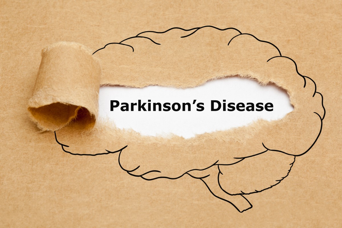 Morbus parkinson = Penyakit Parkinson = Penyakit Parkinson - animasi otak dengan penyakit Parkinson di tengah