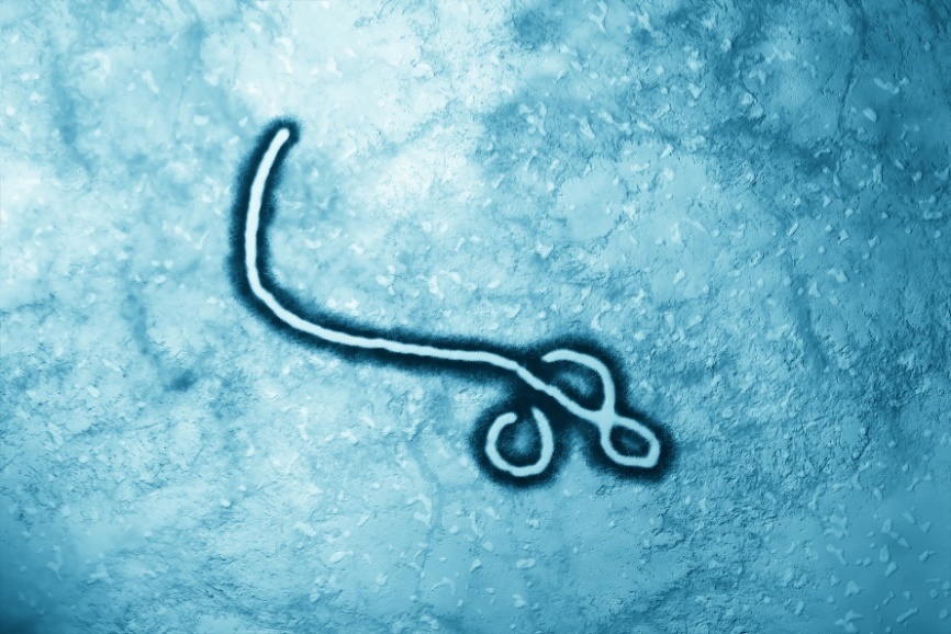 Virus Ebola di bawah mikroskop