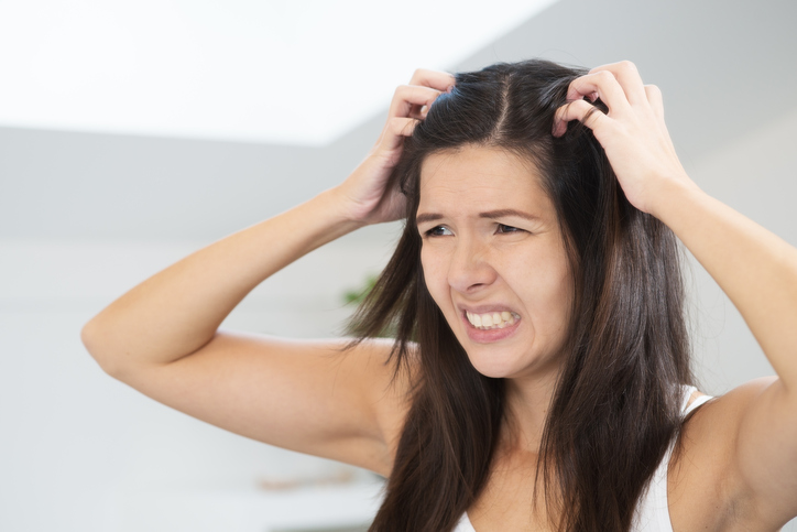 Seorang wanita memiliki masalah rambut, ketombe, kulit kepala gatal, menggaruk-garuk kepalanya dengan tangan