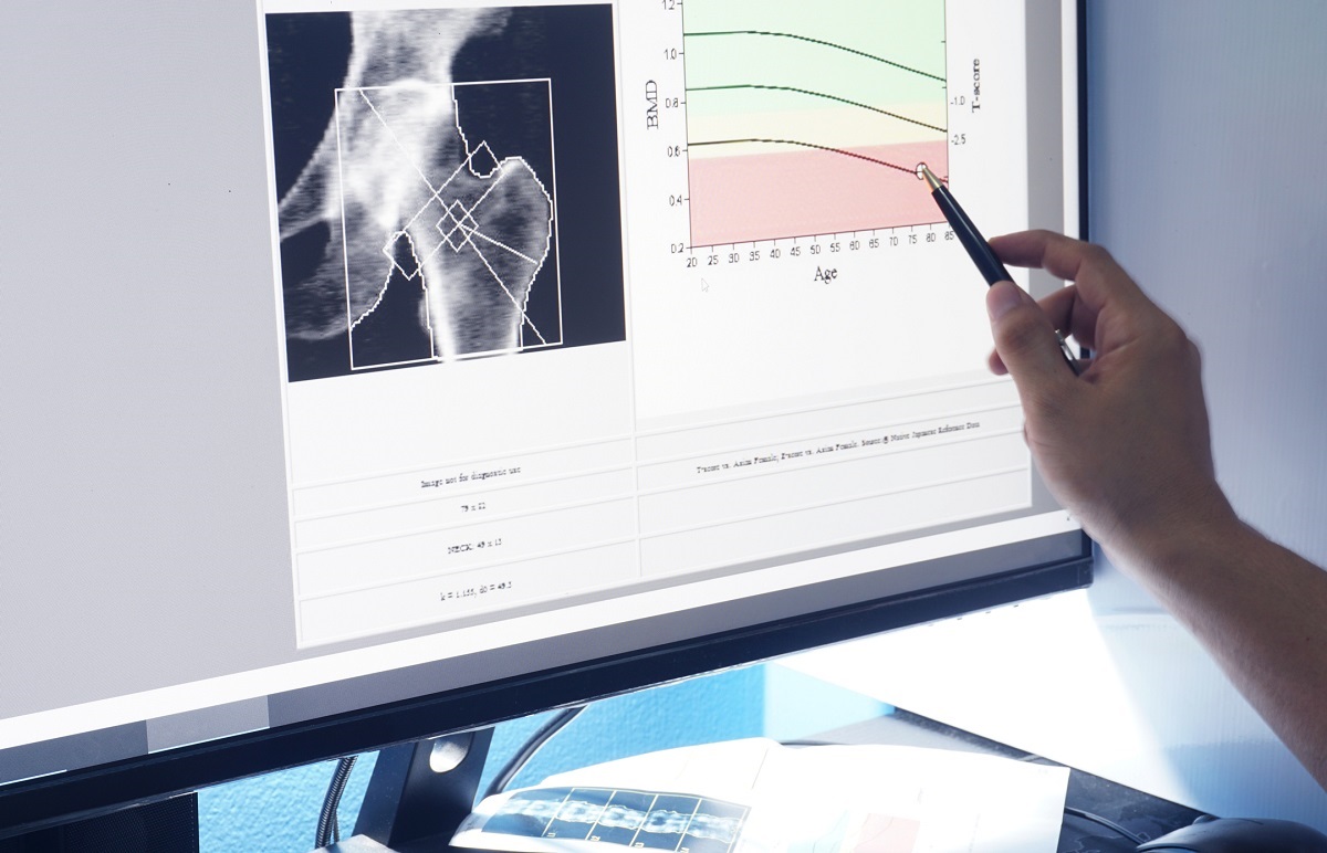 Gambar densitometer dan representasi nilai secara grafis