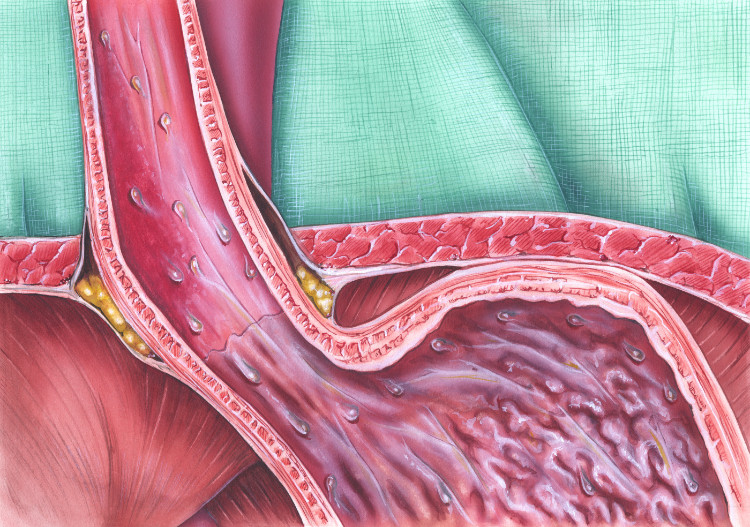 sfingter yang digambarkan secara anatomis pada kerongkongan