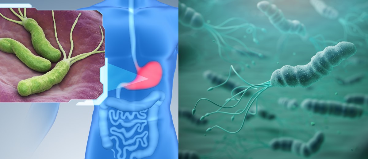 Helicobacter pylori menjajah lapisan lambung dan merupakan faktor risiko gastritis, penyakit maag, dan kanker.