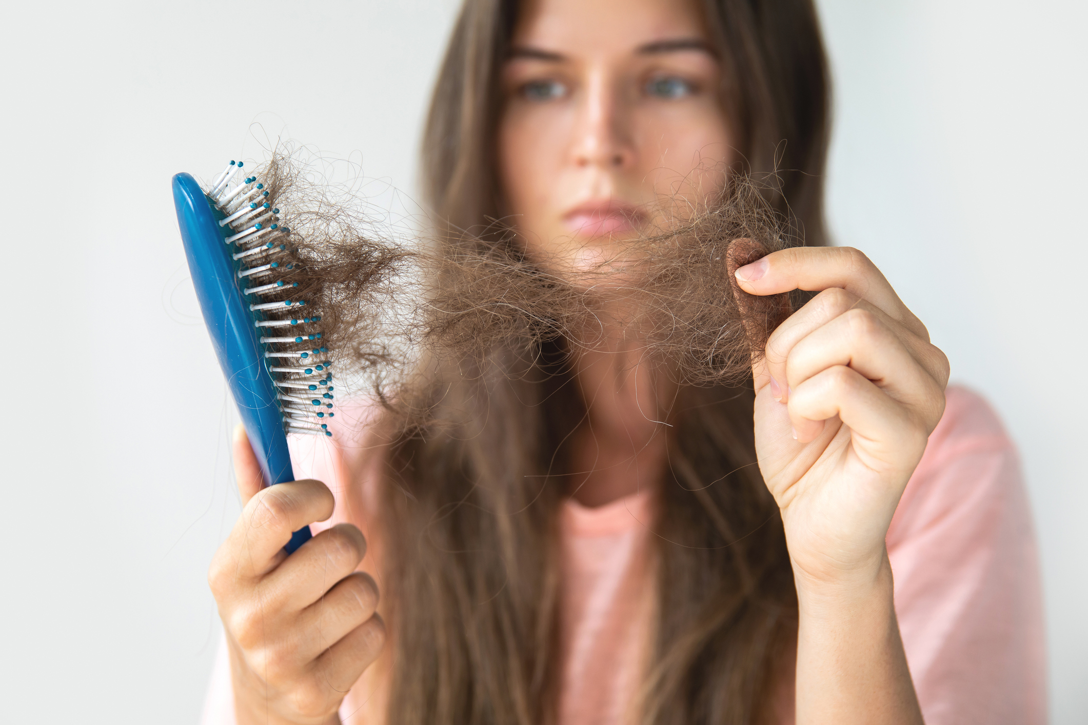 Rambut rontok yang berlebihan