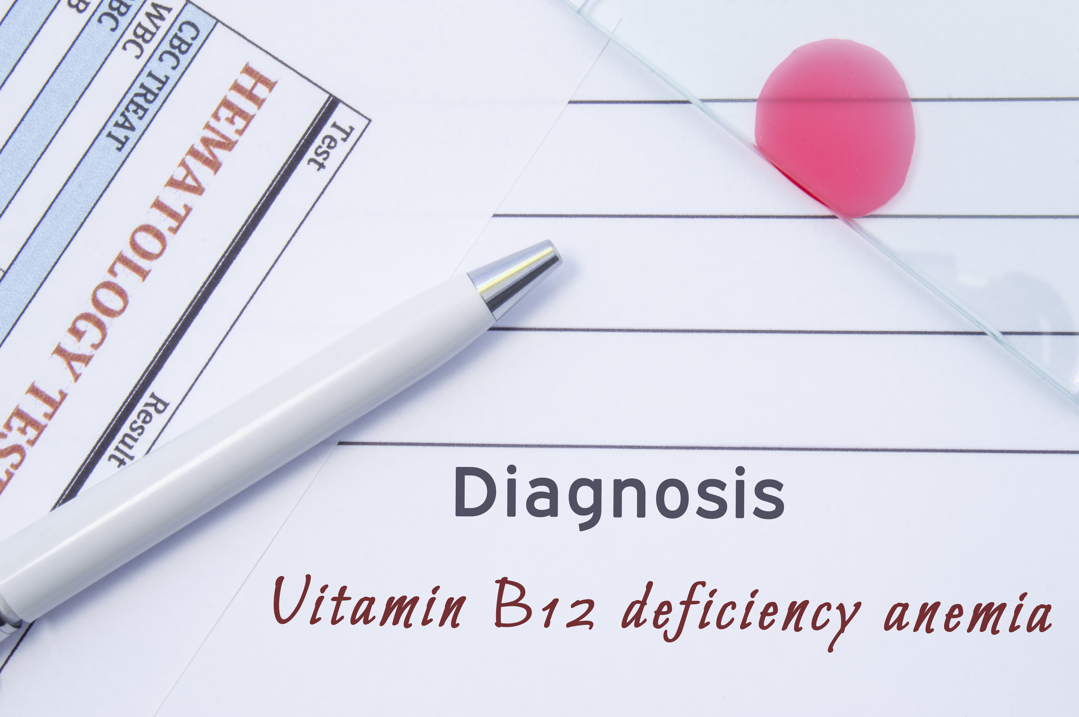 Kekurangan vitamin B12 dapat menyebabkan anemia pernisiosa.