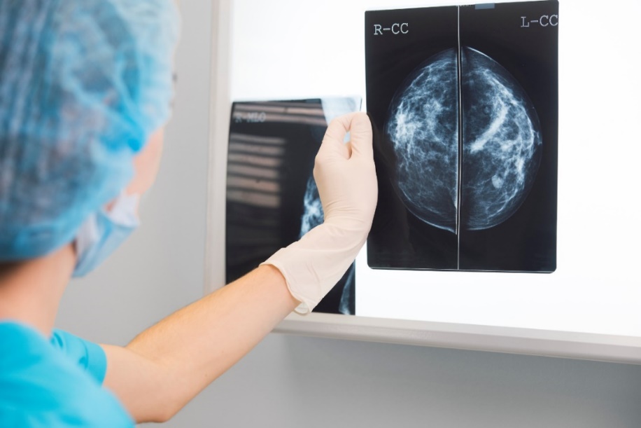 Mammogram payudara