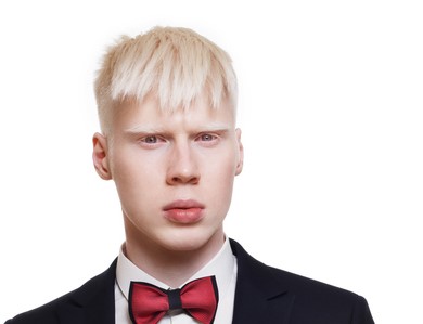 laki-laki albino muda, rambut putih, mengenakan jaket