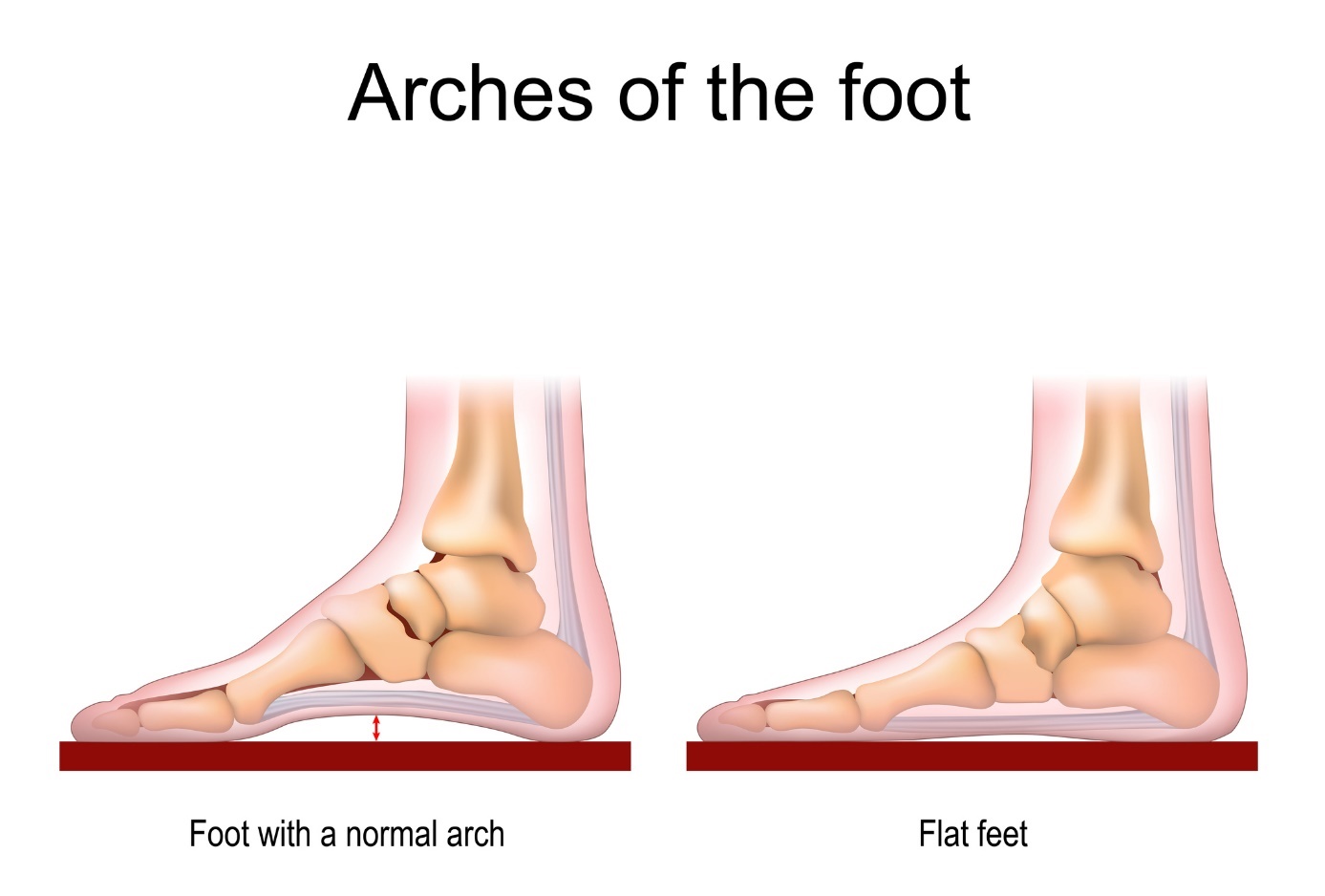 Kaki normal dan datar