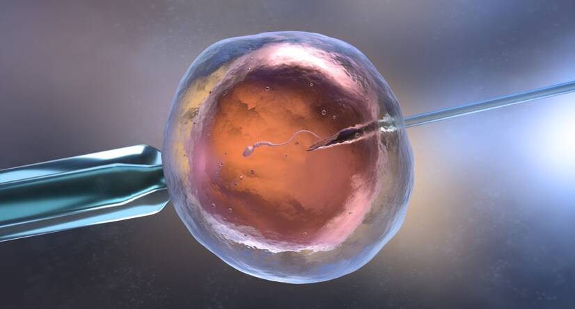 Fertilisasi in vitro IVF (bayi tabung) Sumber: Getty Images