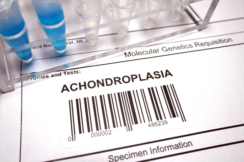 Achondroplasia: Apa saja penyebab dan gejala kelainan tulang bawaan?