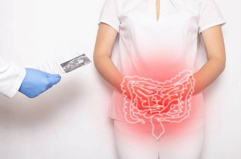 Penyakit Crohn: apa itu, mengapa bisa terjadi dan apa saja gejalanya?