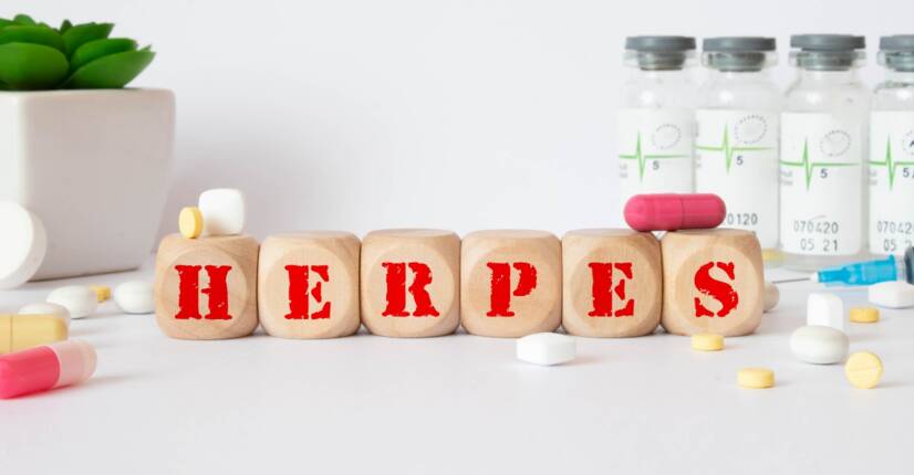 Herpes genital: seperti apa bentuknya dan apa gejalanya? Metode pencegahan