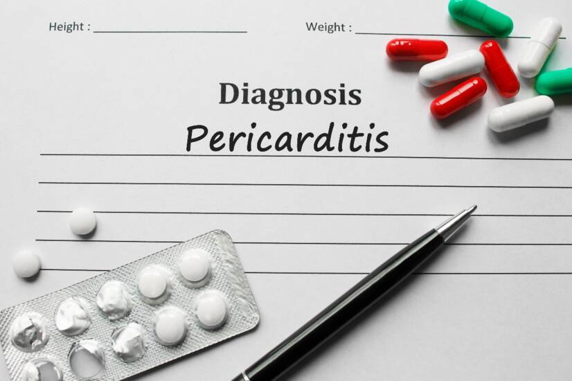 Perikarditis: peradangan pada selaput jantung. Apa penyebab dan gejalanya?