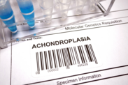 Achondroplasia: Apa saja penyebab dan gejala kelainan tulang bawaan?