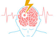 Apa itu stroke? Tahukah Anda gejala, risiko dan pengobatannya?